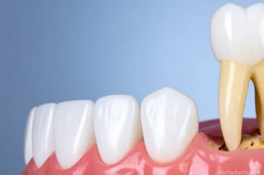 Удаление зуба